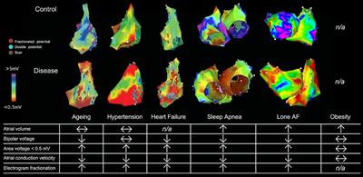 Targeting the Substrate in Ablation of Persistent Atrial Fibrillation: Recent Lessons and Future Directions